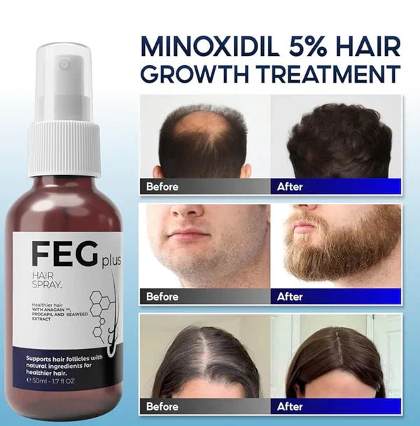 FEG Plus Hair Growth Spray (Original USA Imported)
