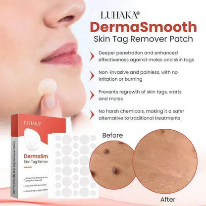Derma Smooth Skin Tag Remover Patches- Buy 1 Get 1 Free