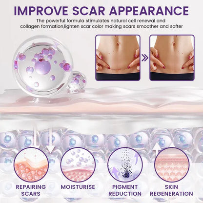 ReGenScar Stem Cell Repair Gel (Visible Scar Improvement in 7 Days) (Buy 1 Get 1 Free)